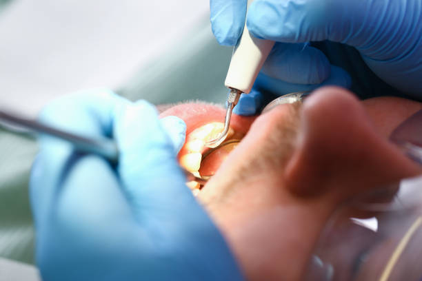 Best Emergency Gum Treatment in Eastwood, MI